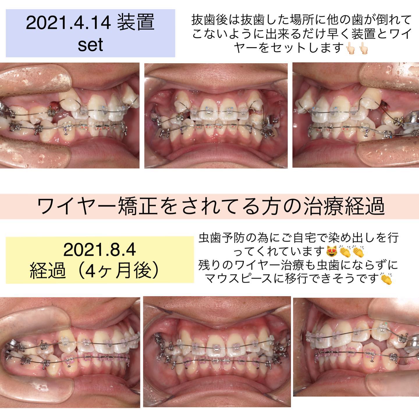 Instagramからの投稿